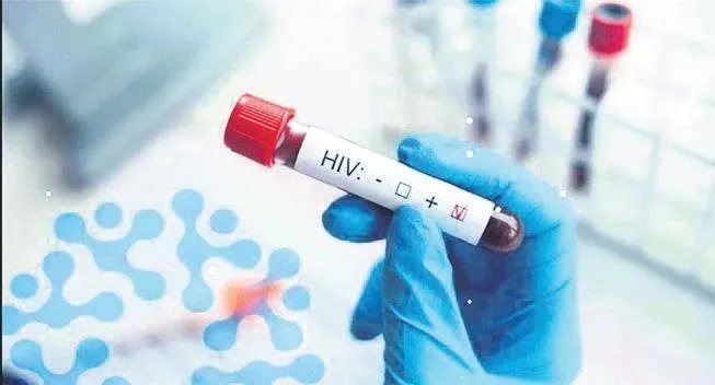 HIV pozitif olduğunu eşinden saklamak