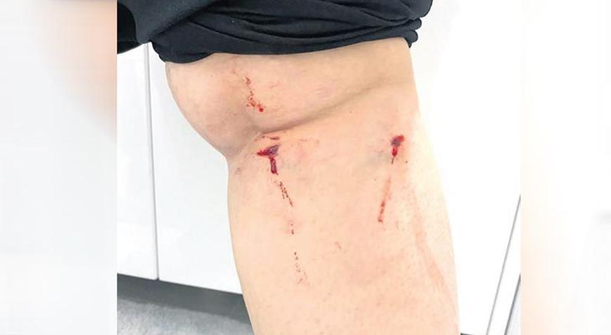 YTÜ kampüsünde öğrenciye köpek saldırdı