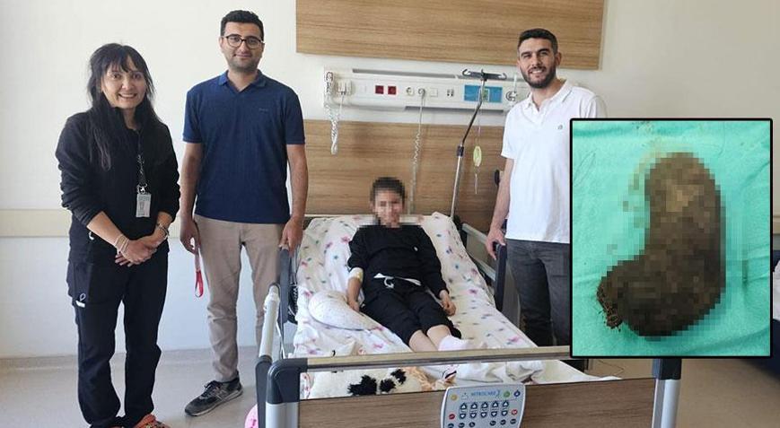 Bulantı ve iştahsızlık şikayetiyle gitti! 9 yaşındaki kızın midesinden çıkanlar şaşkına çevirdi