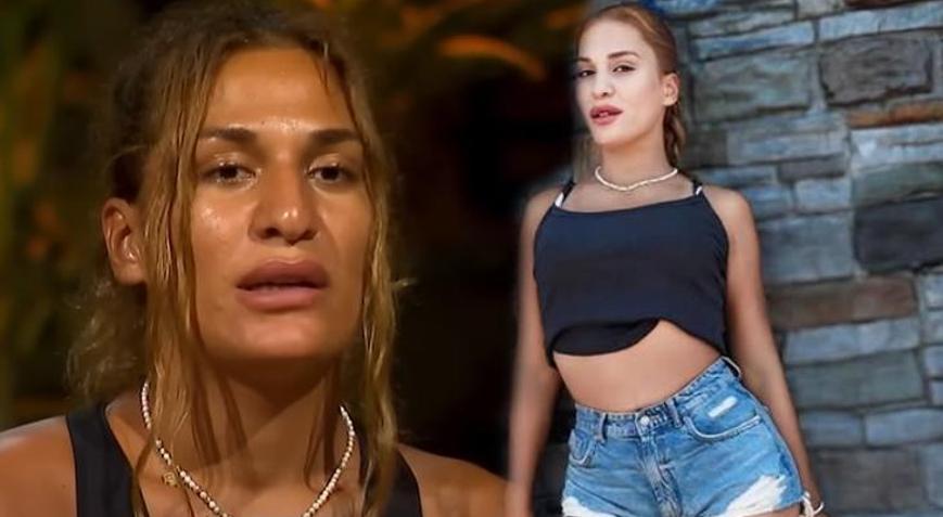 Survivor Almeda burun ameliyatı ardından son halini paylaştı! Değişimi şoke etti