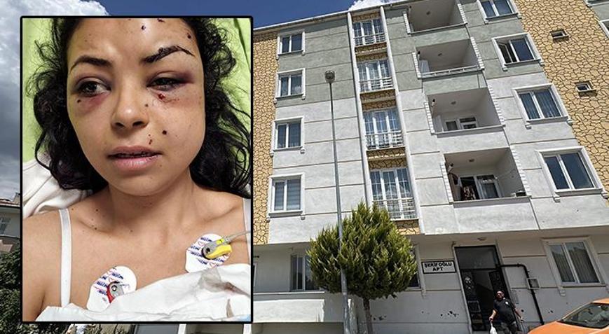Düğünde tüfekli kavga: Pencereden izlerken, gözünden vuruldu