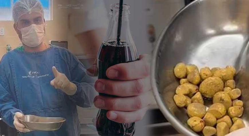 Su yerine 3 litre kola içti! Yaşadıkları korkunç, günlerdir rekor kırıyor: ‘Tarlaya dönmüş’