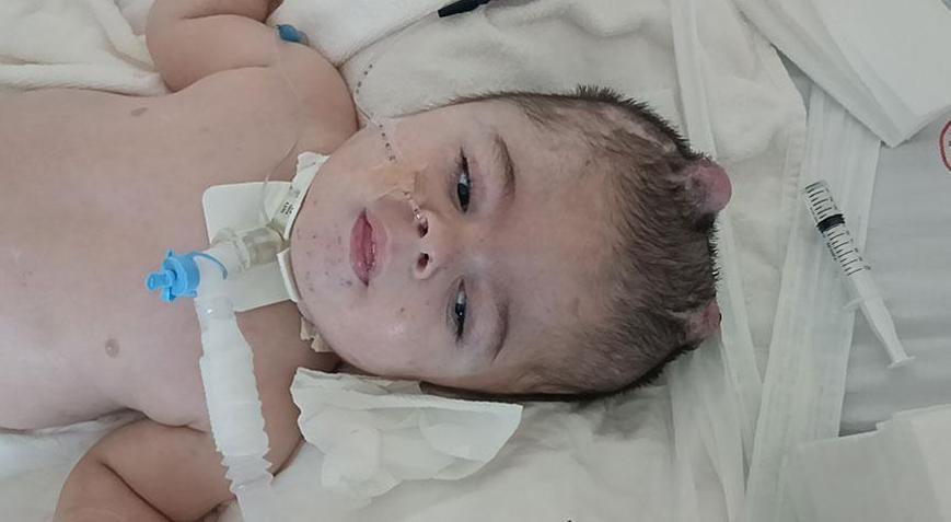 25 ayda 16 ameliyat geçirdi! Minik Ayaz yaşam mücadelesi veriyor