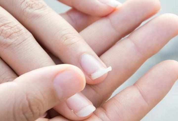 Dolama Nedir, Neden Olur? Dolamaya Ne İyi Gelir, Nasıl Geçer?