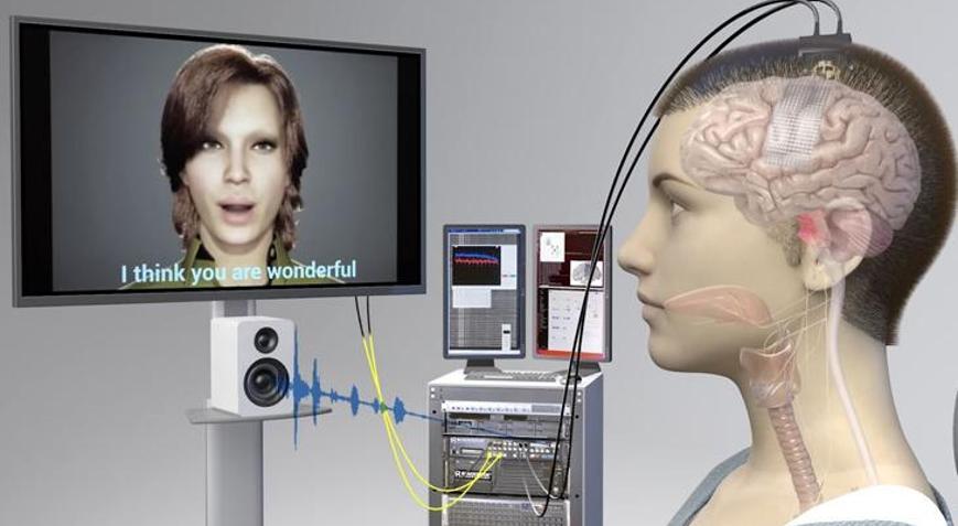 18 yıl sonra konuştu: Felçli hastaya yapay zeka destekli beyin implantı yapıldı