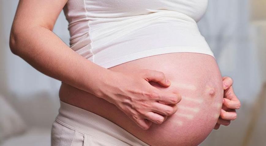 Hamilelikte kaşıntı normal mi, riskli mi? ‘El içi ve ayak tabanı bir alarm’