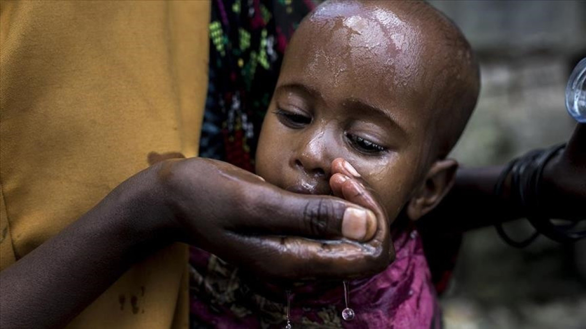 Sudan’da bir yılda 2 bin 741 kişi koleradan öldü
