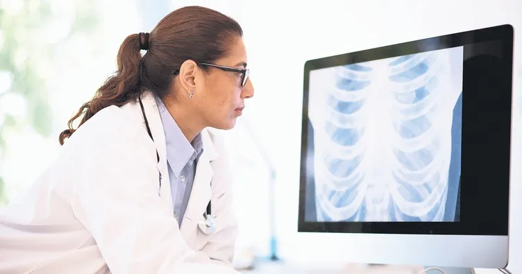 Akciğer kanseri kadınlarda artıyor