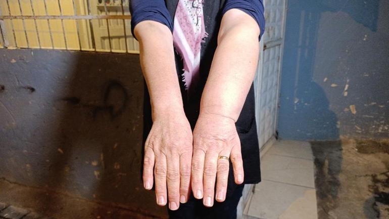 Adana’da komşu vahşeti: KOAH hastası babanın dişlerini kırdı, anne ile oğlunu bıçakladı