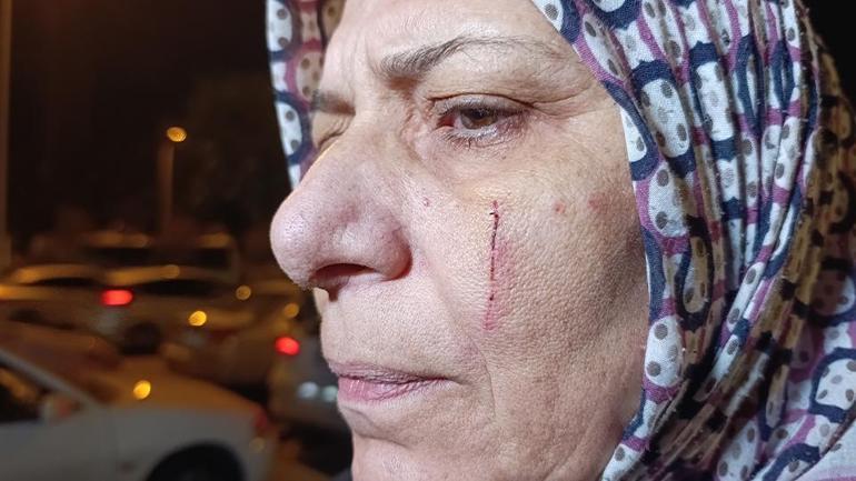 Adana’da komşu vahşeti: KOAH hastası babanın dişlerini kırdı, anne ile oğlunu bıçakladı