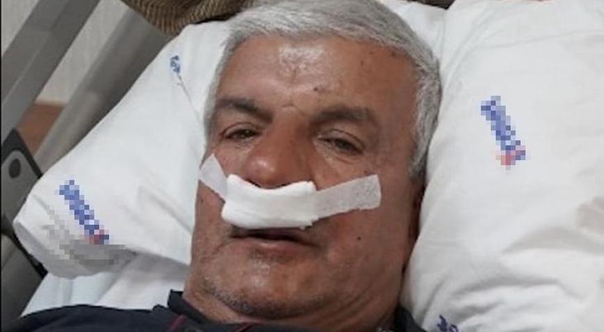 Meslekten dolayı oluşmuş! 65 yaşındaki adamın burnundan taş çıkarıldı