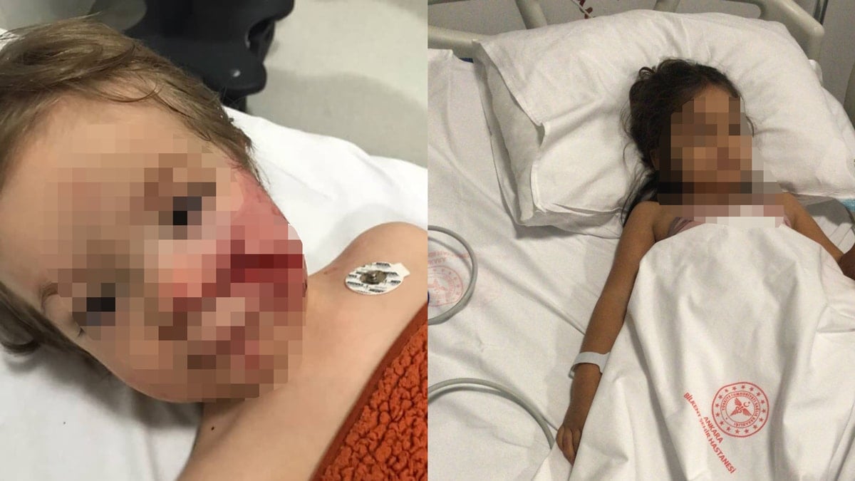 Bakan Yerlikaya duyurdu: Pitbull’un sahibi tutuklandı