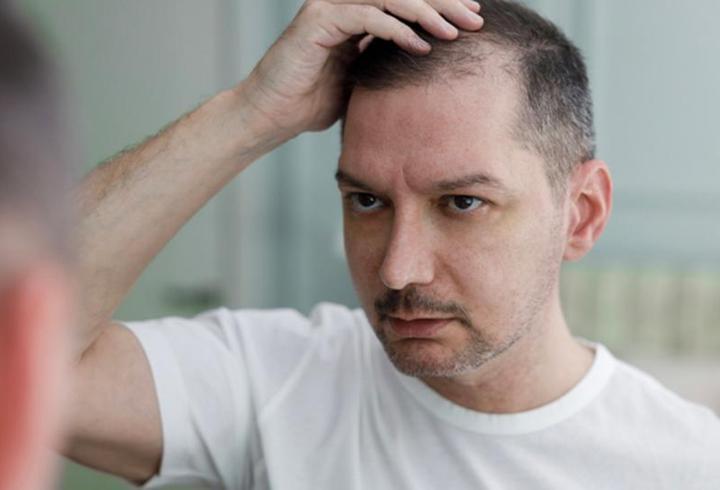 Tıpta yeni sayfa açacak çalışma! Kellik probleminin sonu mu geliyor