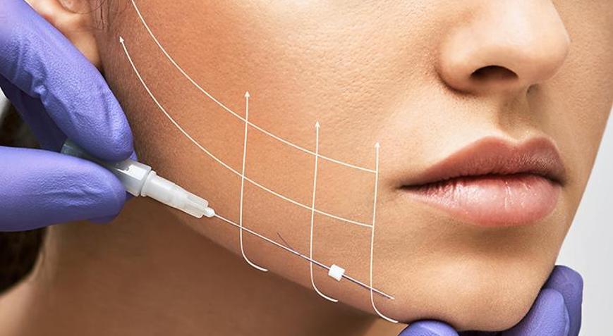 ‘Derin plan yüz germe’ tekniği kalıcılığıyla fark yaratıyor