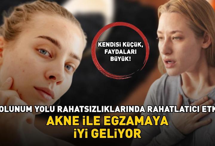AKTARLARIN EN ÇOK SATANI! Faydaları saymakla bitmiyor: Akne ile egzamaya iyi geliyor; solunum yolu rahatsızlıklarında rahatlatıcı etki gösteriyor