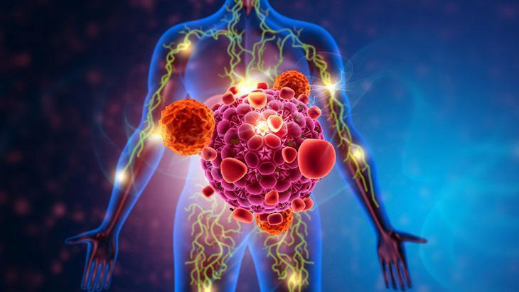Vücuttaki gizli kanser hücrelerine dikkat! Görüntüleme ve testler her zaman yeterli mi?