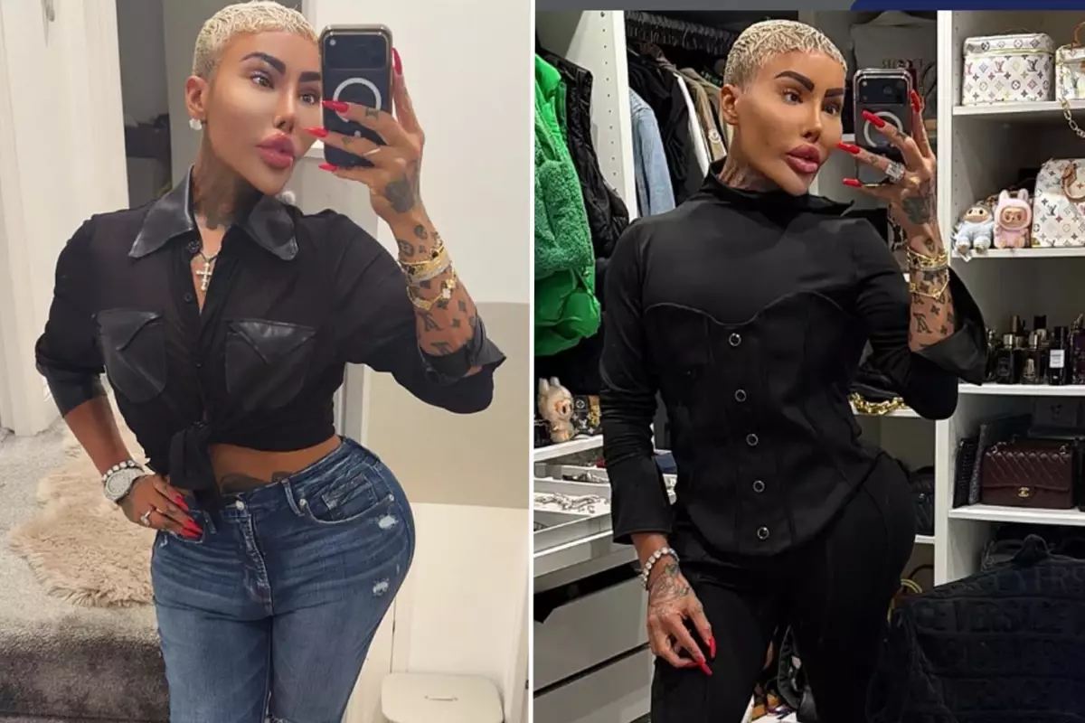 Kim Kardashian’a benzemek için estetik yaptıran fenomen hayatını kaybetti: 2 kişi cinayetten tutuklandı