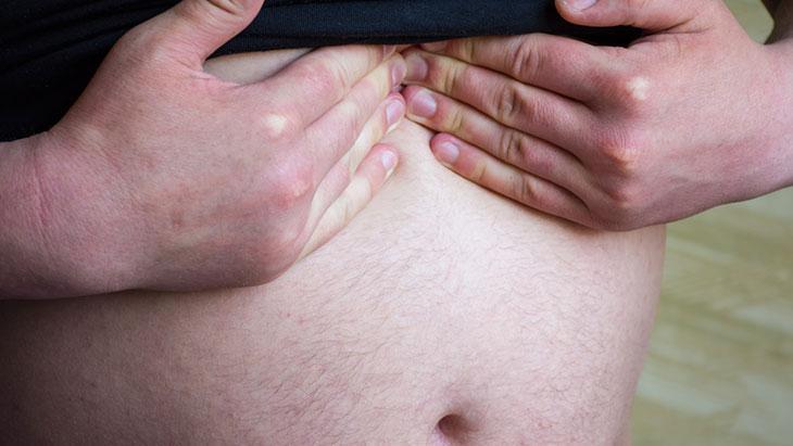 Her 5 kişiden birinin sorunu! Dev karın fıtığı hayatı kabusa çeviriyor