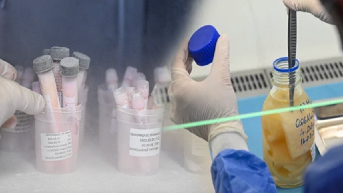 Ölen insanların derileri Türkiye’deki bu merkezde saklanıyor!