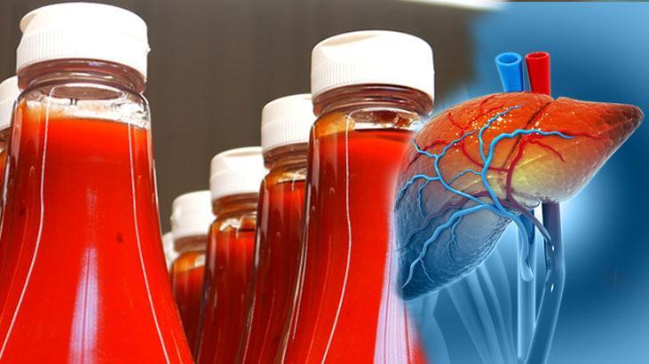 Lezzetine aldanan yandı! Karaciğeri parçalayan besin, iltihabı sessiz