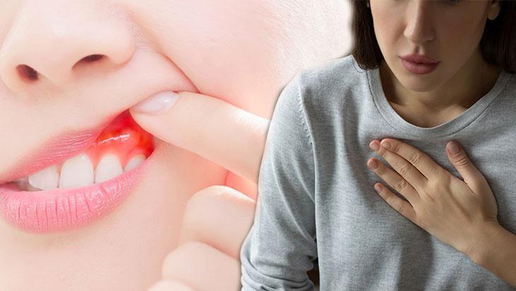 Diş eti kanaması masum değil! Kalp hastalıkları, Alzheimer ve kanserle yakından ilişkili