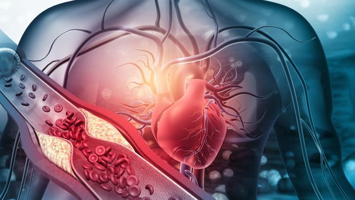 Sadece kolesterol başlı başına bir problem!