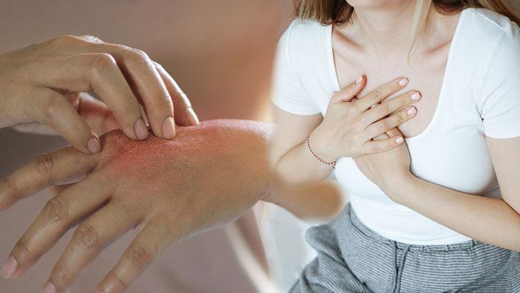 “Alerji” deyip geçmeyin! Sadece ciltte değil, kalpte de etkili olabiliyor