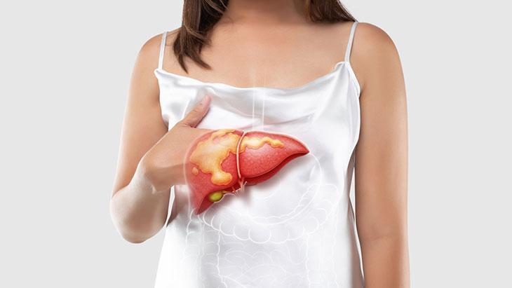 Sessiz ilerliyor, büyük hasar veriyor! Karaciğerinizi korumak için 5 hatadan kaçının