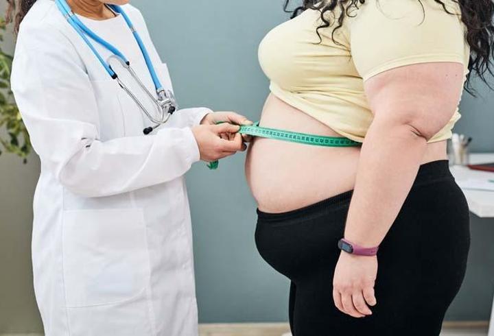 Obezite Tedavisinde Endoskopik Mide Uygulaması Nedir?