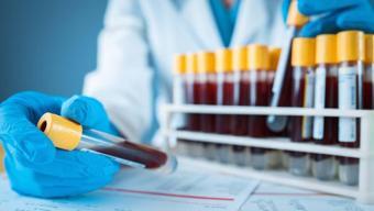 Depresyon tanısında yeni dönem: Kan testleri ruh sağlığı araştırmalarını değiştirebilir
