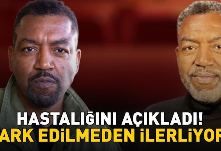 Grey’s Anatomy’nin Yıldızı Russell Andrews Hastalığını Açıkladı! Bu Belirtilere Dikkat! Fark Edilmeden İlerliyor!