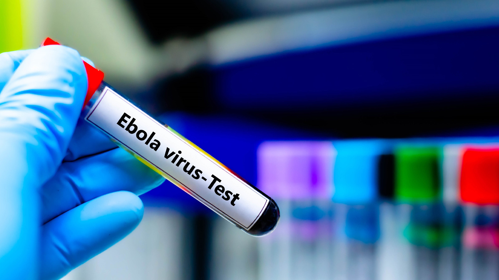 İsrail’de ilk kez Ebola şüphesiyle bir kişi karantinaya alındı